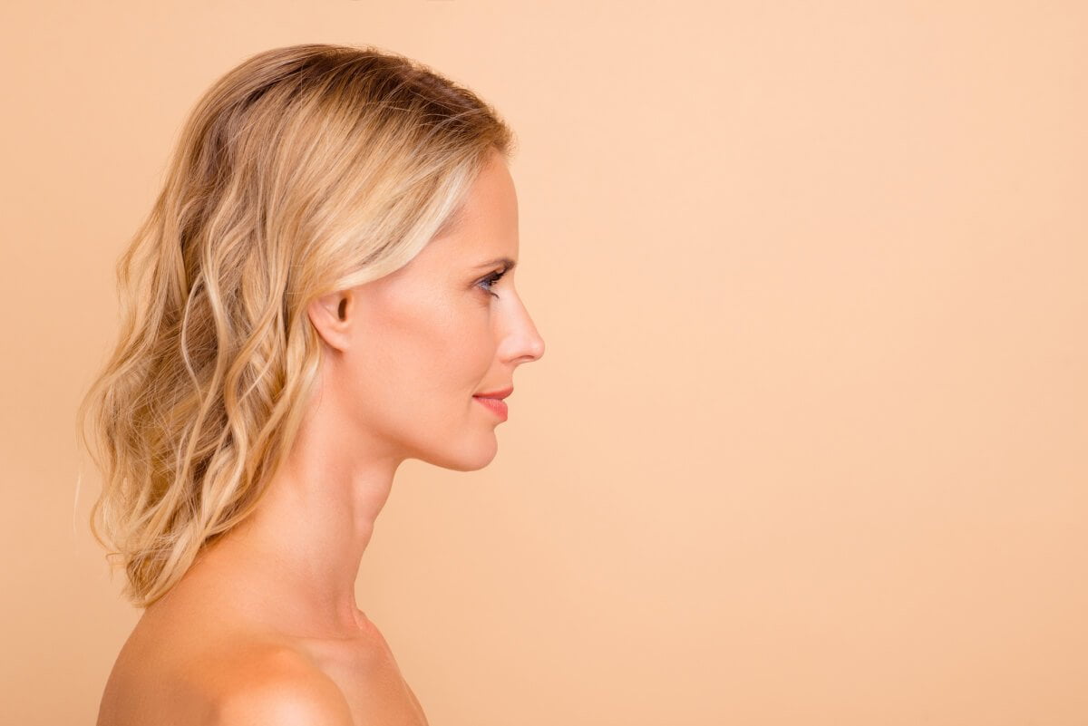 Woman with neck lift after BOTOX and injectables