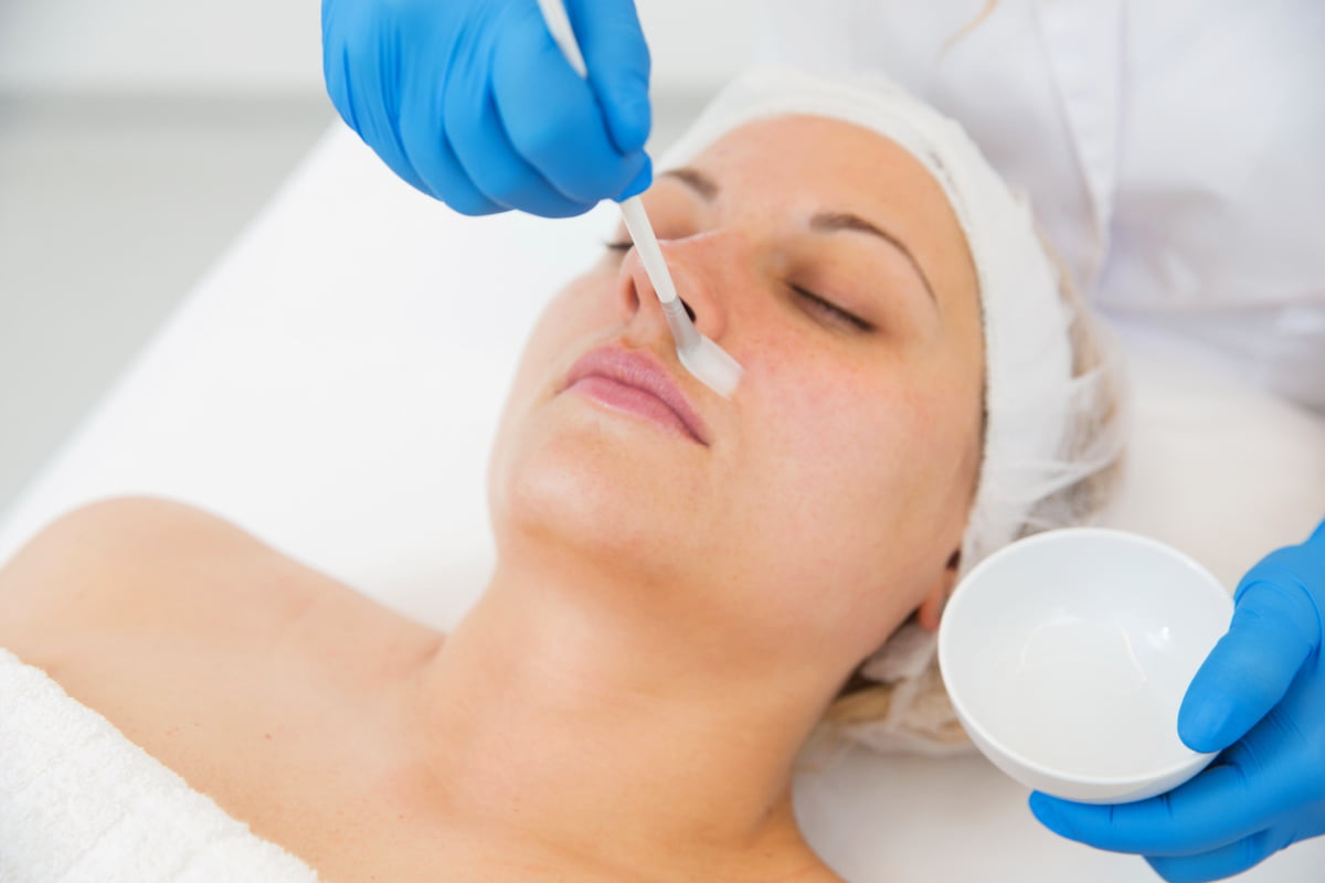 Woman getting a chemical peel treatment at a medical spa