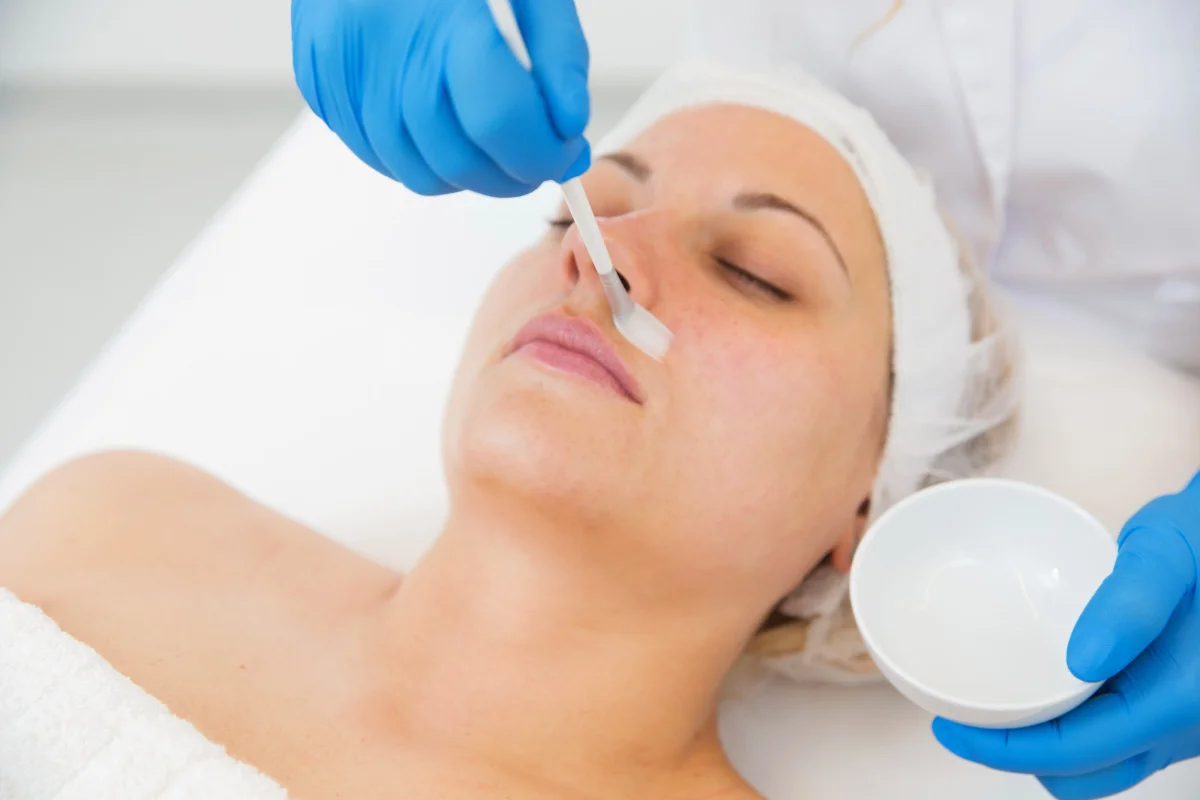 Woman getting a chemical peel treatment at a medical spa