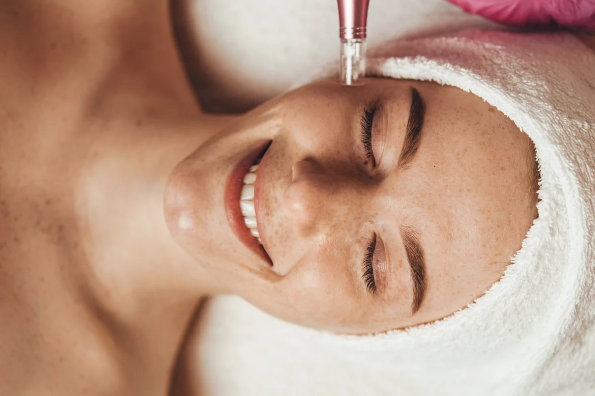 Young woman getting a microneedling treatment at a med spa