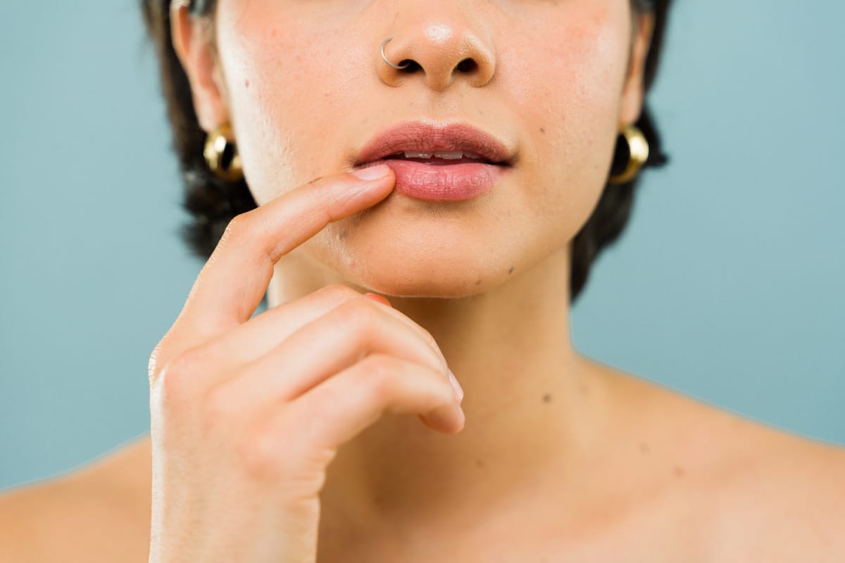 Can I get lip filler if I have really thin lips?