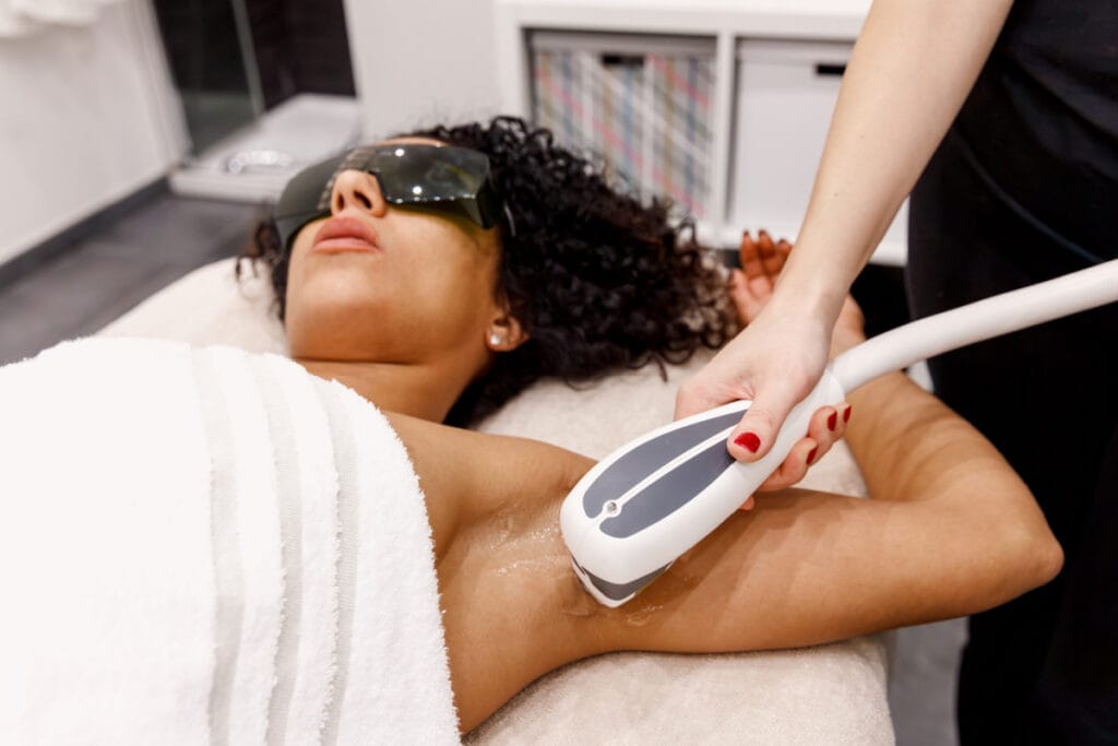 Underarm hair removal with laser hair removal